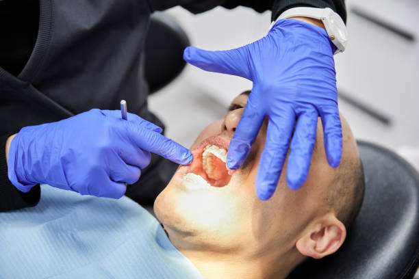 Best Emergency Dentist for Knocked-Out Tooth in Wading River, NY