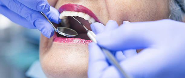 Best Emergency Dentist for Lost Fillings or Crowns in Wading River, NY